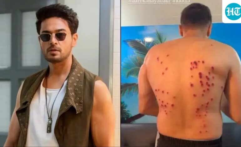 ‘Most painful experience ever’: Gaurav Khanna suffers back injury after Khatron Ke Khiladi 15 stunt