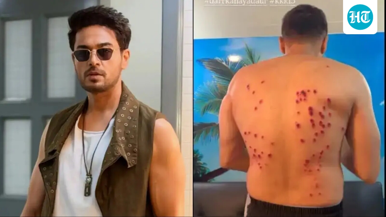 ‘Most painful experience ever’: Gaurav Khanna suffers back injury after Khatron Ke Khiladi 15 stunt