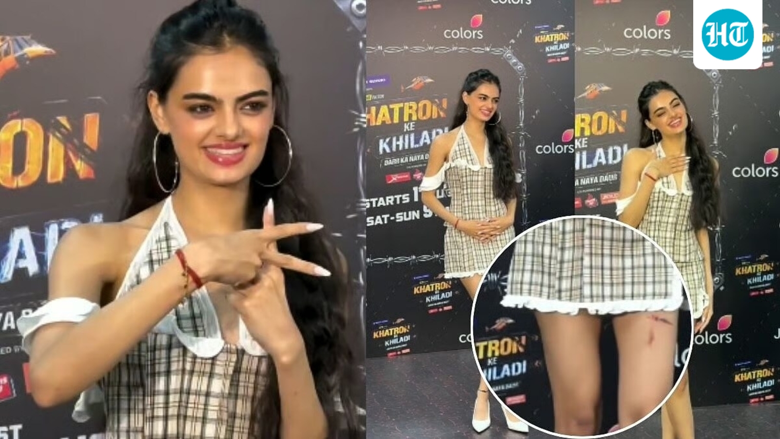 Exclusive | Did Ruhanika Dhawan get injured during Khatron Ke Khiladi 15 shoot? Actor denies
