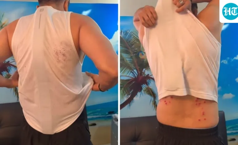 ‘It’s not brutal’: Khatron Ke Khiladi maker on safety concerns after Gaurav Khanna’s scary injuries go viral | Exclusive